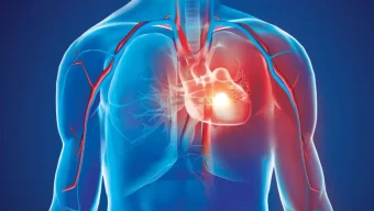 হৃদরোগে মৃত্যু বাড়ছে চিকিৎসা সীমিত