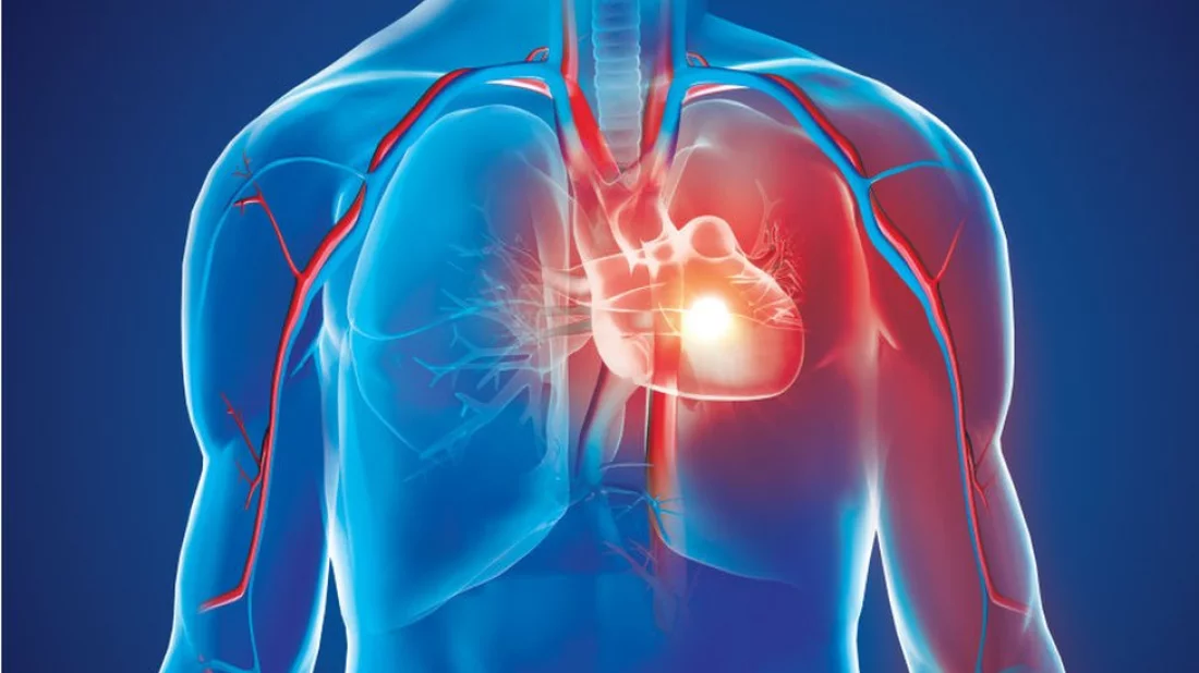 হৃদরোগে মৃত্যু বাড়ছে চিকিৎসা সীমিত