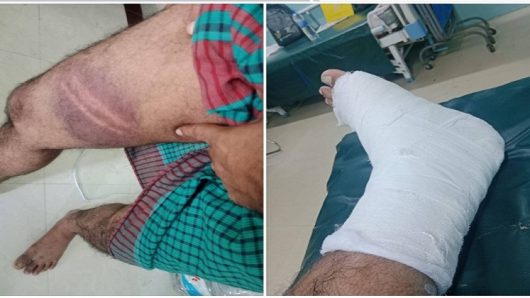 উত্তরায় জামাত নেতার কান্ড, কিডন্যাপ শেষে পিটিয়ে ভেঙে দিলেন পা