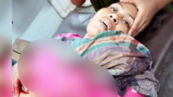 চুয়াডাঙ্গার হকপাড়ার সেলিনাকে কুপিয়ে ক্ষতবিক্ষত, আশংকাজনক অবস্থায় রাজশাহী রেফার্ড